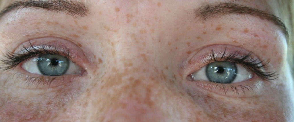 ¿Pecas, manchas y arrugas? 5 acciones para prevenirlas